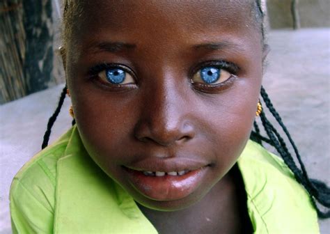 solomon islanders melanesian blonde hair blue eyes